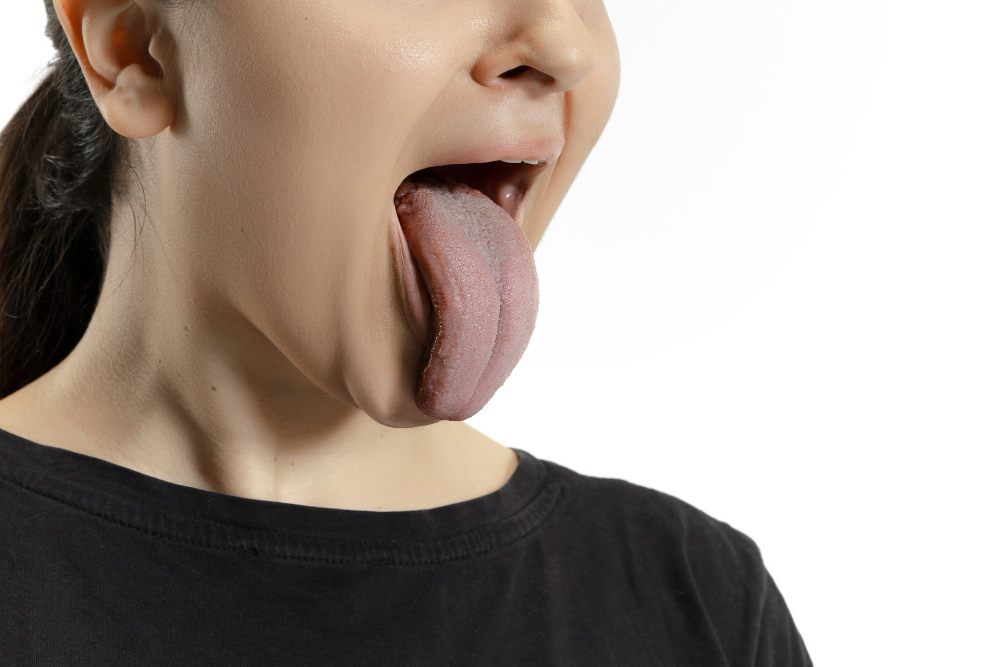 When Should You Use a Tongue Scraper? Key Reasons and Best ...